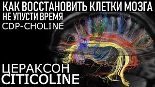 Цитиколин CDPcholine Цераксон Обзор Советы ЛУЧШИЙ НООТРОП Is This The Best Nootropic [upl. by Henriha]