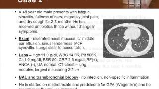 Detecting Vasculitis Before Its Too Late [upl. by Groh]