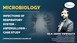 Microbiology  Aspergillosis  Case study  Raaonline [upl. by Giffy]