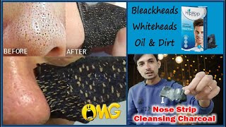 Best nose strips for blackheads in India  Hip Hop nose strips review  Nose Strip  Nose strip uses [upl. by Ynnig13]