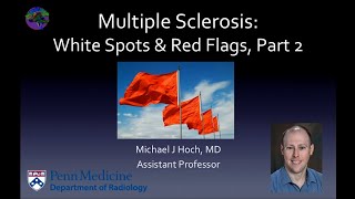 Multiple sclerosis – white spots and red flags  part 2  Mimics and Variants [upl. by Moscow349]