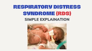 Respiratory Distress Syndrome RDS Simple Explanation  Paediatrics tutorial [upl. by Ruthven740]