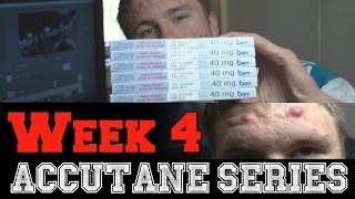 Roaccutane Series Week 4 Doctor Visit amp ReDosing [upl. by Yelich]