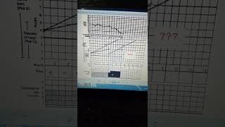 Partogram Quiz 3 [upl. by Jadda50]