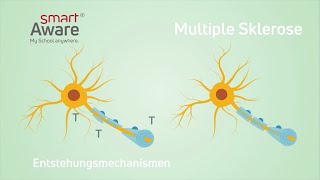 Multiple Sklerose Entstehungsmechanismen I Fachfortbildungen in der Pflege  smartAware [upl. by Stevena]