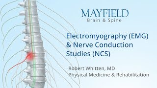 Electromyography EMG amp Nerve conduction studies NCS [upl. by Winola853]