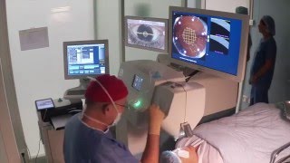 Laser Assisted Cataract Surgery procedure amp settings [upl. by Philo]