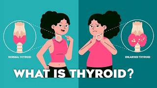 Thyroid Gland T3 T4 Thyroid Hormones and Thyroid Problems Animation thyroid [upl. by Goebel]