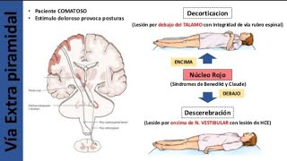 Diferencias entre descerebración y decorticación neurofisiologia [upl. by Ahsital407]