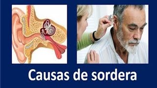 9 Causas comunes de sordera tinnitus y daño al oído [upl. by Hnah881]