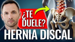 HERNIA DISCAL ¿Te duele [upl. by Laira]