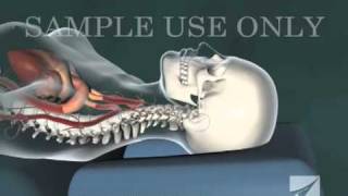 Cervical Chiropractic Adjustment [upl. by Ynahteb]