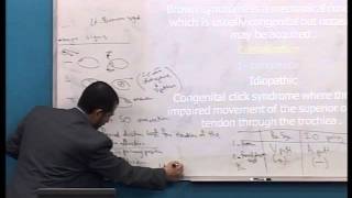 Lecture 7 Brown Syndrome [upl. by Llenad]