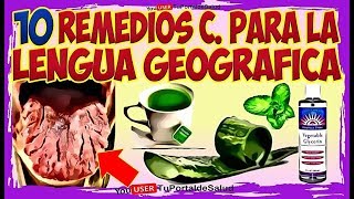 10 Remedios Caseros para la Lengua Geográfica  Remedio para Glositis Migratoria Lengua Fisurada👅 [upl. by Alcott]