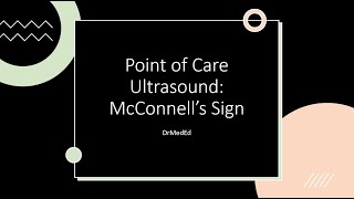 Point of Care Ultrasound POCUS McConnells Sign [upl. by Redmund]