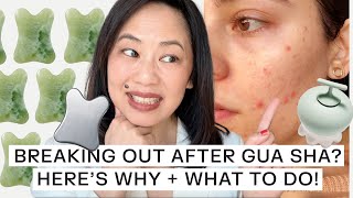 TCM Practitioner Explains Gua Sha Breakouts And How To Prevent Them [upl. by Saunder697]