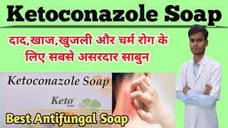 keto soap uses in hindi  Ketoconazole soap uses in hindi  ketofast soap  fungal infection का इलाज [upl. by Nnaynaffit]