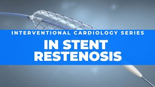 In stent restenosis  Risk factors pathology identification and management [upl. by Schultz499]