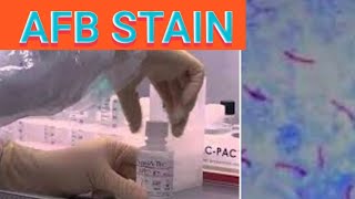 Sputum AFB stain procedure Acid fast staining Sputum staining procedure  laboratorymicrobiology [upl. by Einoj]