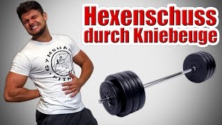 Schmerztherapie  Hexenschuss und Rückenschmerzen verhindern [upl. by Reina556]