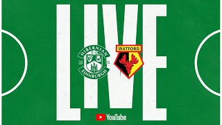 LIVE Hibernian vs Watford  PreSeason Fixture [upl. by Fellner]