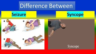 Difference Between Seizure and Syncope [upl. by Creight]