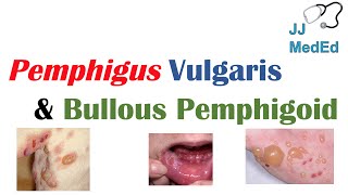 Vesiculobullous Skin Diseases  Pemphigus Vulgaris vs Bullous Pemphigoid [upl. by Aihsia741]