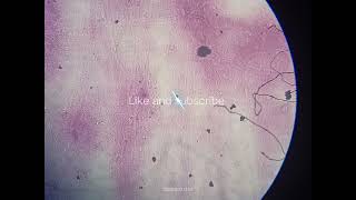 Nerve cells Histology [upl. by Romonda]