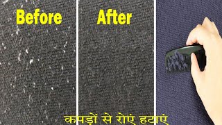 एक मिनट में कपड़ों से रोएं निकालने के 5 नींजा टेक्निक जानें।Remove Lint Ball From Clothes। [upl. by Artima]