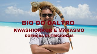 KWASHIORKOR E MARASMO  CASOS DE DESNUTRIÇÃO [upl. by Nedrob]