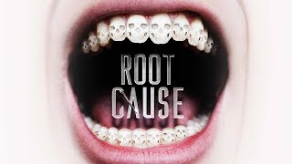 Root Cause The Movie [upl. by Reeva749]