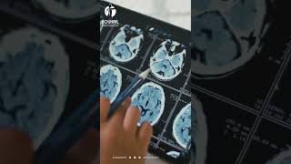 Comprendre la Radiographie  Une Fenêtre sur Votre Santé 💡🔍 [upl. by Othe248]