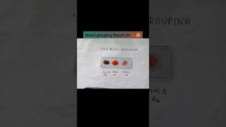 Blood grouping test 🩸🧪 youtubeshorts shorts trending viralvideo [upl. by Ressler]