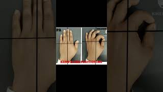 Hand x ray positioning short video [upl. by Nivets]