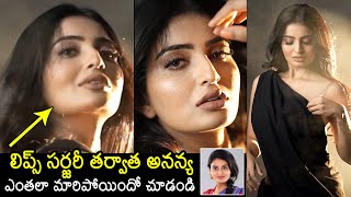 Ananya Nagalla Latest SH0CKING Transformation Visuals After Lip Surgery  News Buzz [upl. by Olegnaid26]