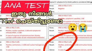 ANA Blood test എന്താണ് എപ്പോൾ ചെയ്യണംMalayalam [upl. by Azral650]