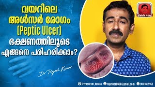 വയറിലെ അൾസർ രോഗം Peptic Ulcer ഭക്ഷണത്തിലൂടെ എങ്ങനെ പരിഹരിക്കാം [upl. by Ykciv408]