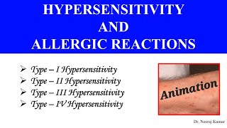 Type I II III amp IV Hypersensitivity Animation  Allergic reactions [upl. by Adnaval]