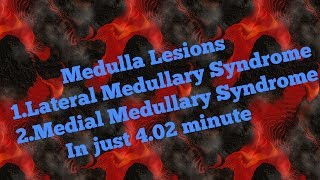 Medulla lesionsMedial and Lateral Medullary Syndrome IN Hindi [upl. by Aseram255]