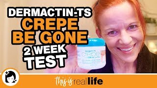 DermactinTS Crepe Be Gone 2 Week Test Video  THIS IS REAL LIFE [upl. by Atnom572]