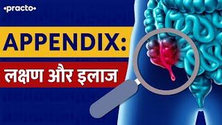 Appendix What Are Symptoms of Appendicitis  Appendicitis Treatment In Hindi  Practo [upl. by Mosenthal]