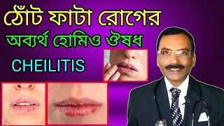 ঠোঁট ফাটা রোগের অব্যর্থ হোমিওপ্যাথিক ঔষধ  Cheilitis treatment  dr SP Goswami [upl. by Aiciram]