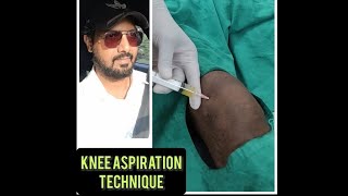 Knee AspirationHemarthrosis DrainSynovial fluid aspirationseptic arthritis joint lavage [upl. by Comyns]