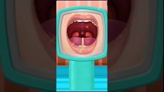 Doctor surgery gameTonsils Removal Surgery👀 viralvideo shorts gaming [upl. by Lenka]