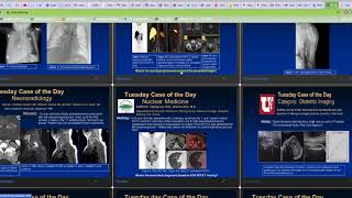 Virtual RSNA 2020 How to view lectures educational exhibits and cases of the day [upl. by Darmit265]