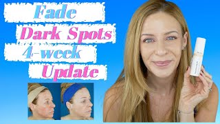 How I Got Rid of Dark Spots and Hyperpigmentation  Musely Spot Cream Review  Hydroquinone [upl. by Anitac]