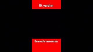 İlk yardım esmarch manevrası [upl. by Lamonica]