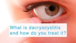 What is dacryocystitis and how do you treat it [upl. by Dwinnell]