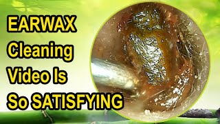 EARWAX Cleaning Video Is So SATISFYING With Relaxing Sound [upl. by Shayla]