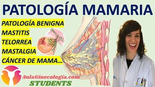 PATOLOGÍA MAMARIA AulaGinecología  STUDENTS PATOLOGÍA BENIGNA MASTITIS CÁNCER DE MAMA [upl. by Marrilee230]